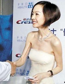 减肥过度的女明星,揭秘减肥过度的女明星背后的故事