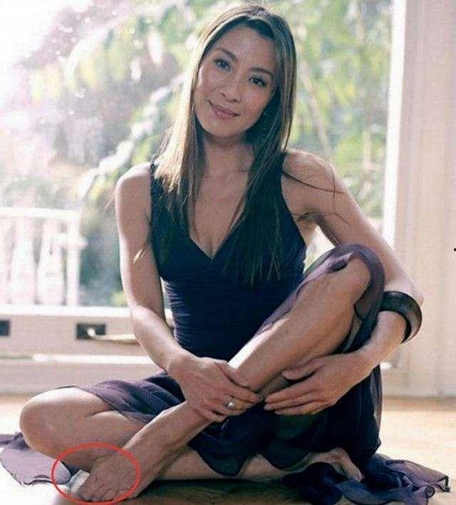 哪些明星身上有残疾,盘点身怀残疾的璀璨明星